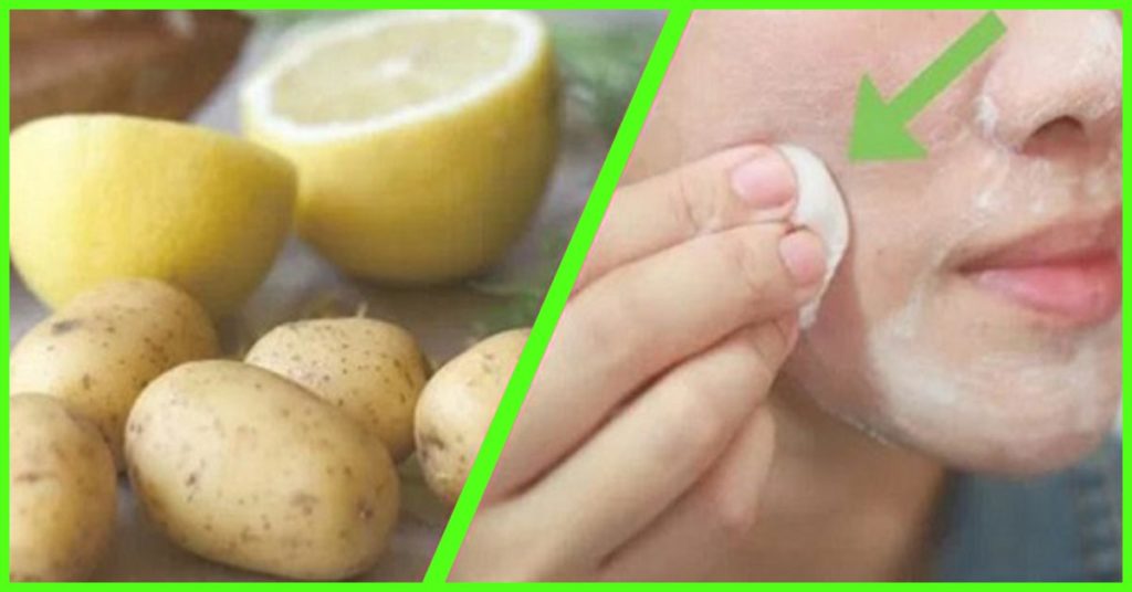 Raw Potato & Lemon For Skin