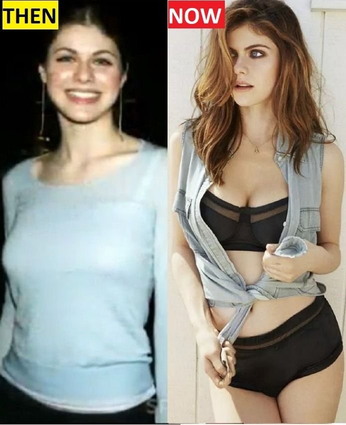 Alexandra Daddario Changes